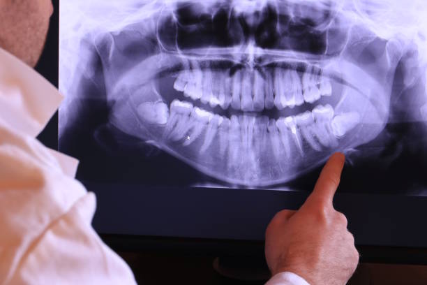 Best Emergency Treatment for Jaw Pain or Injury in Atlantic Beach, NC